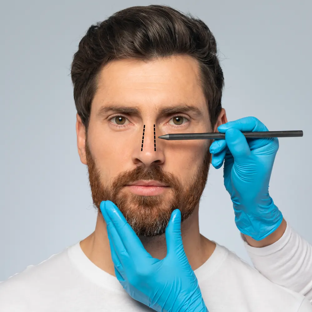 صورة توضيحية لتجميل الأنف