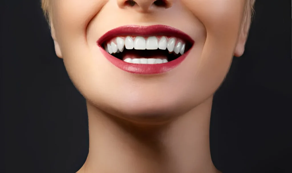 ابتسامة هوليوود